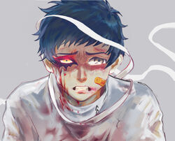  1boy bandages bandaid bleeding blood blood_on_clothes blood_on_face blue_hair bruise bruise_on_face clenched_teeth commentary_request deep_wound grey_background grey_eyes heterochromia highres houhou_(pixiv4771938) injury looking_at_viewer male_focus mishima_yuuki persona persona_5 reverse_ryona simple_background solo tears teeth upper_body yellow_eyes 