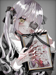  2girls absurdres aegyo_sal bad_id bad_pixiv_id bandages black_dress blood blood_splatter bow collar cross dress ear_piercing earrings eyepatch goth_fashion grey_background hair_ornament hanataro_(sruvhqkehy1zied) highres holding holding_photo iei jewelry lichtenberg_figure lightning_scar magical_girl multiple_girls nail_polish original photo_(object) picture_frame piercing ribbon scar scar_on_face smile twintails upper_body white_hair yami_kawaii yellow_eyes 