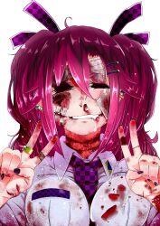  abuse bad_id bad_pixiv_id bandages bandaid bandaid_on_face bandaid_on_hand blood blood_on_clothes blood_on_face breasts bruise checkered closed_eyes commentary cuts double_v drooling earrings female fingernails glasgow_smile guro hair_between_eyes hair_ornament hair_ribbon hairclip hata-tan_(rui_(hershe)) himekaidou_hatate injury jewelry large_breasts long_hair nail_polish necktie no_headwear purple_hair ribbon ring ryona sakurai_energy saliva scar shirt simple_background smile solo stitches touhou upper_body v white_background white_shirt 