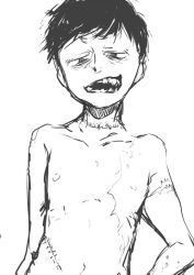  1boy bags_under_eyes collarbone commentary_request half-closed_eyes hanada_hyou hand_on_own_hip male_focus matsuno_ichimatsu navel open_mouth osomatsu-san osomatsu_(series) scar scar_on_arm scar_on_cheek scar_on_face scar_on_stomach short_hair simple_background skinny smile solo teeth topless_male upper_body white_background 